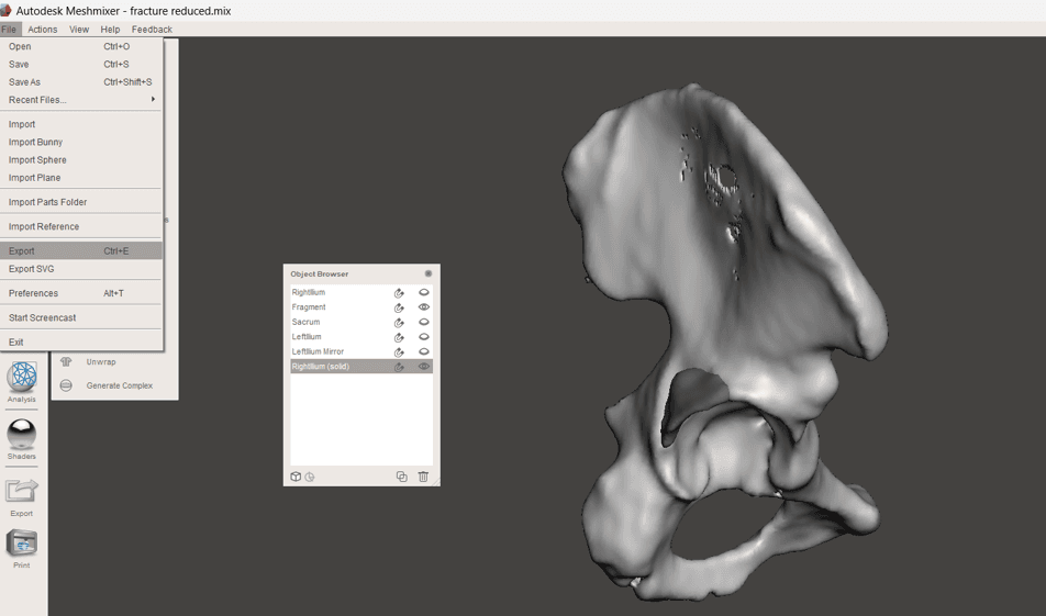 Virtual Surgical Planning for Pelvis Reconstruction course
