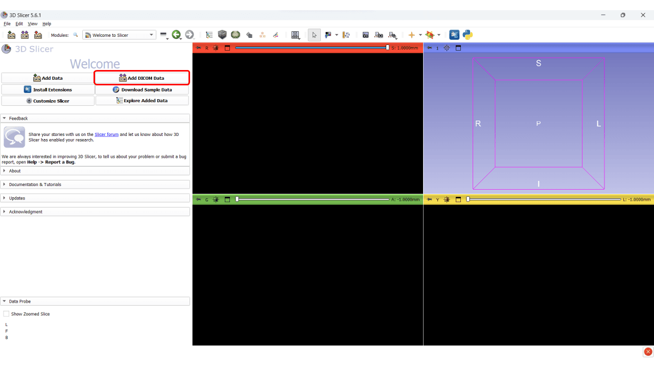Virtual Surgical Planning for Mandibular Reconstruction course